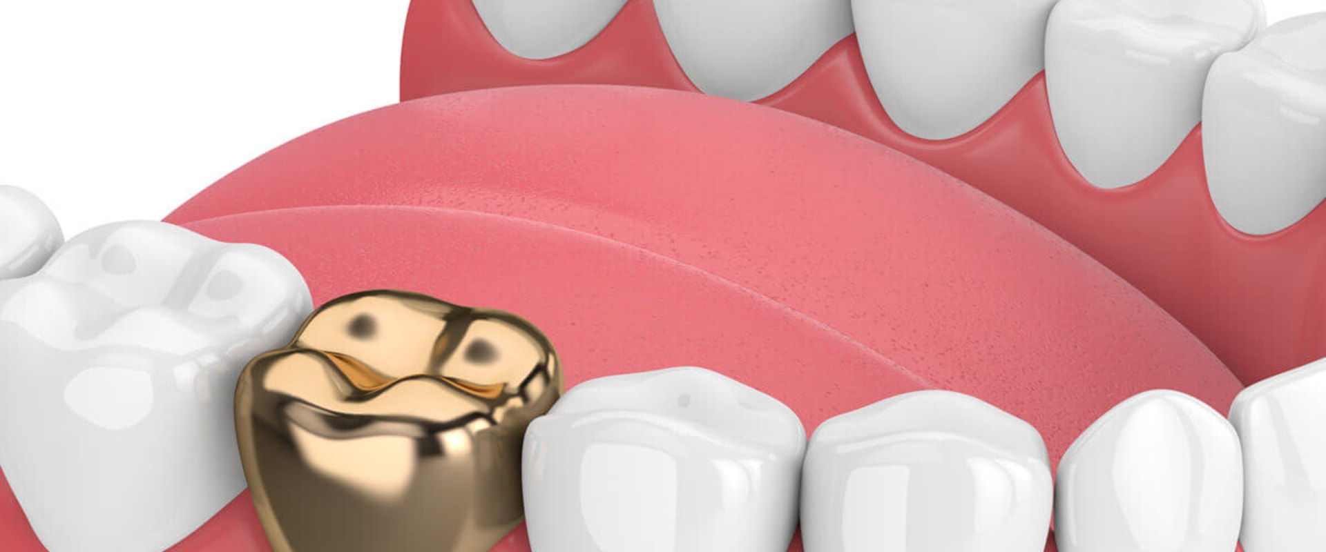 What are the two disadvantages of gold?